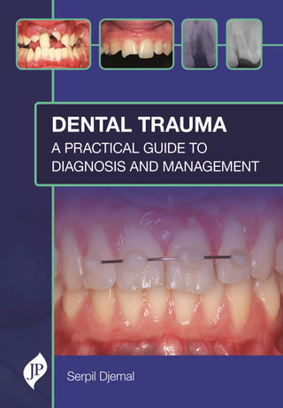 Dental Trauma: A Practical Guide to Diagnosis and Management