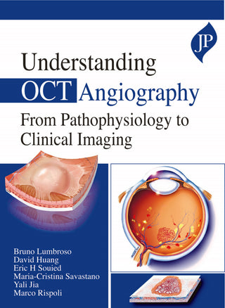 Understanding OCT Angiography From Pathophysiology to Clinical Imaging