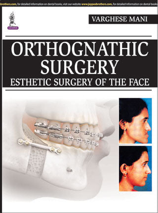 Orthognathic Surgery : Esthetic Surgery of the Face