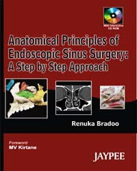 Anatomical Principles of Endoscopic Sinus Surgery (with CD-ROM)