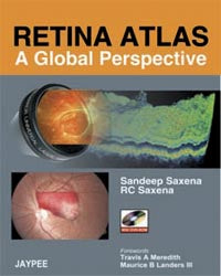 Retina Atlas-A Global Perspective (with DVD-ROM)