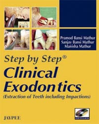 Step by Step Clinical Exodontics (with DVD-ROM)