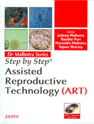 Dr Malhotra Series: Step by Step Assisted Reproductive Technology (ART) (With 2 Interactive DVD-ROMs)