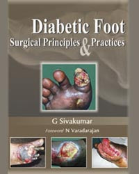 Diabetic Foot Surgical Principles and Practices