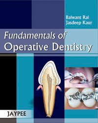 Fundamentals of operative dentistry