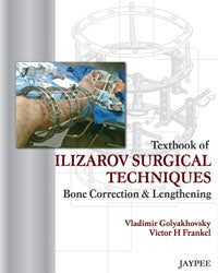 Textbook of Ilizarov Surgical Techniques: Bone Correction and Lengthening