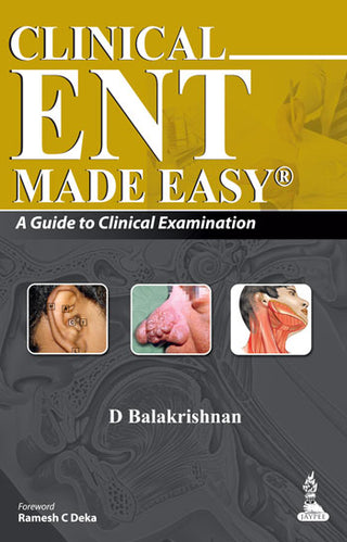 Clinical ENT Made Easy: A Guide to Clinical Examination