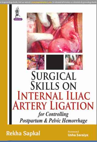 Surgical Skills on Internal Iliac Artery Ligation for Controlling Postpartum & Pelvic Hemorrhage