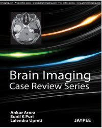 Brain Imaging: Case Review Series
