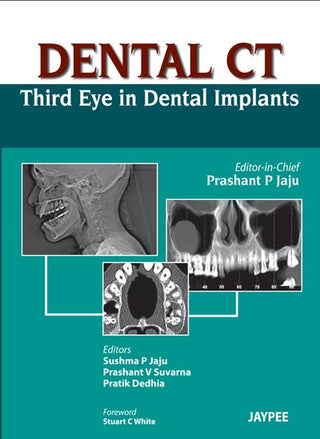 Dental CT: Third Eye in Dental Implants