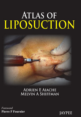 Atlas of Liposuction