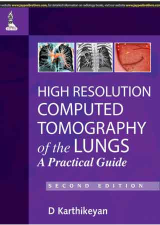 High Resolution Computed Tomography of the Lungs: A Practical Guide