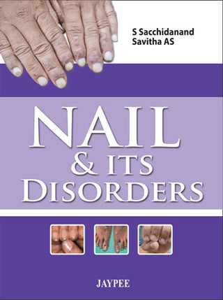 Nail and Its Disorders