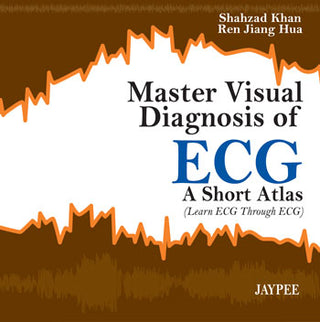 Master Visual Diagnosis of ECG: A Short Atlas (Learn ECG Through ECG)