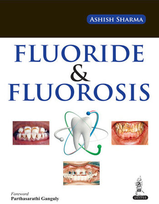 Fluoride and Fluorosis (A Research Review)