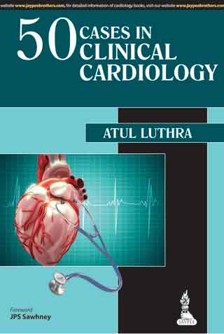 50 Cases in Clinical Cardiology: A Problem Solving Approach