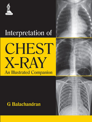 Interpretation of Chest X-ray: An Illustrated Companion