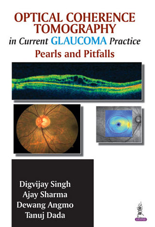 Optical Coherence Tomography in Current Glaucoma Practice Pearls and Pitfalls