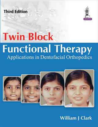 Twin Block Functional Therapy—Applications in Dentofacial Orthopedics