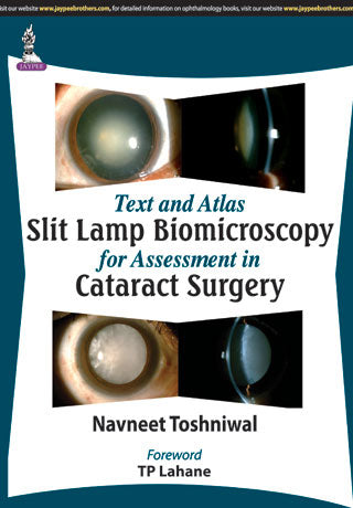 Text and Atlas—Slit Lamp Biomicroscopy for Assessment in Cataract Surgery