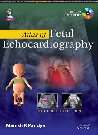 Atlas of Fetal Echocardiography (Includes DVD-ROM)