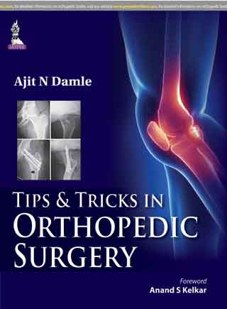 Tips and Tricks in Orthopedic Surgery