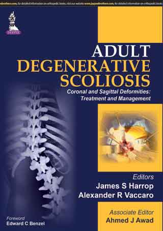 Adult Degenerative Scoliosis—Coronal and Sagittal Deformities: Treatment and Management