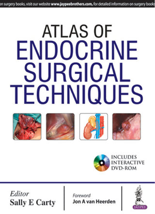 Atlas of Endocrine Surgical Techniques (Includes Interactive DVD-ROM)