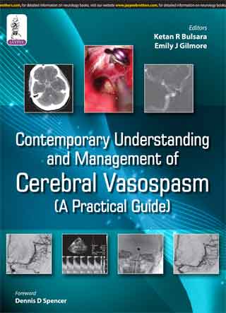 Contemporary Understanding and Management of Cerebral Vasospasm: A Practical Guide
