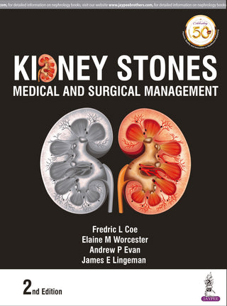 Kidney Stones Medical and Surgical Management