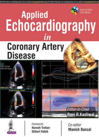Applied Echocardiography in Coronary Artery Disease (Includes CD-ROM)