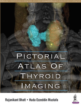 Pictorial Atlas Of Thyroid Imaging