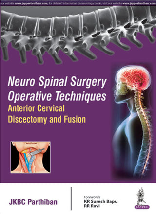 Neuro Spinal Surgery Operative Techniques: Anterior Cervical Discectomy and Fusion