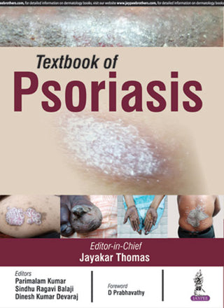 Textbook of Psoriasis