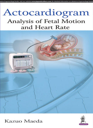 Actocardiogram: Analysis of Fetal Motion and Heart Rate
