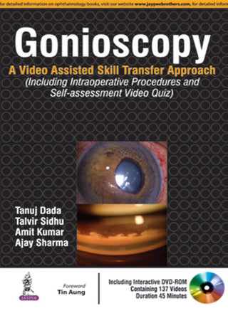 Gonioscopy: A Video Assisted Skill Transfer Approach (Includes Interactive DVD-ROM )