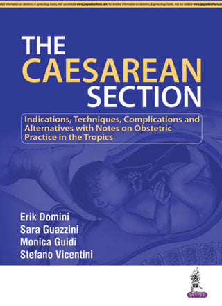 The Caesarean Section