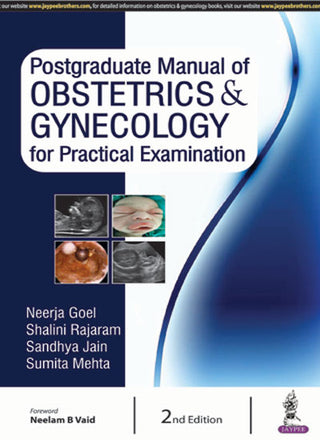 Postgraduate Manual of Obstetrics and Gynecology for Practical Examination