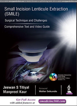 Small Incision Lenticule Extraction (SMILE): Surgical Technique and Challenges (Comprehensive Text and Video Guide)