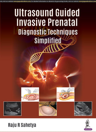 Ultrasound Guided 'Invasive Prenatal Diagnostic Techniques' Simplified