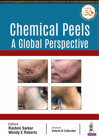 Chemical Peels A Global Perspective