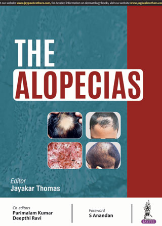 The Alopecias