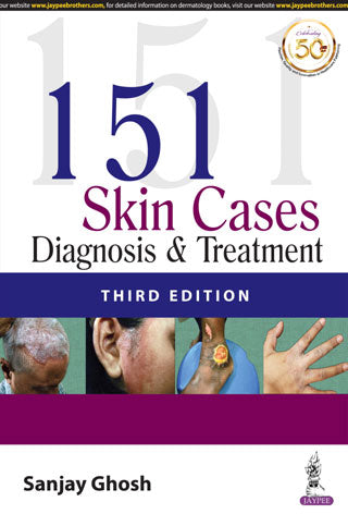 151 Skin Cases: Diagnosis & Treatment