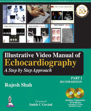 Illustrative Video Manual of Echocardiography: A Step by Step Approach (Part I)