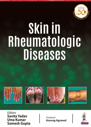 Skin in Rheumatologic Diseases