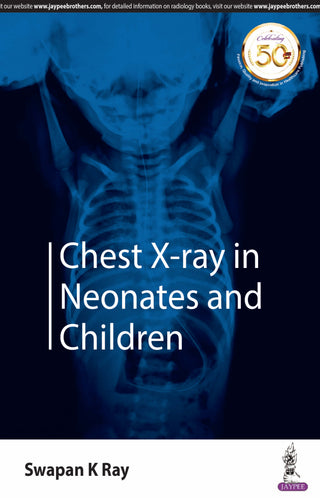 Chest X-ray in Neonates and Children