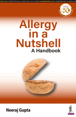 Allergy in a Nutshell: A Handbook