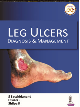 Leg Ulcers Diagnosis & Management