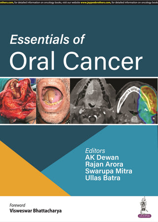 Essentials of Oral Cancer