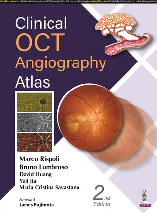 Clinical OCT Angiography Atlas